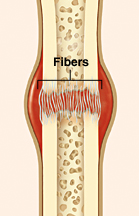 Cross section of broken bone showing fibers forming in blood clot at break.