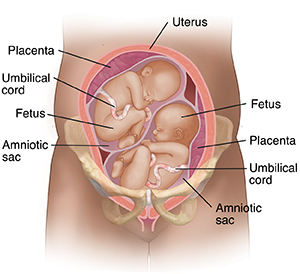 Front view cross section of pregnant uterus in pelvic bones showing two fetuses.