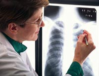 Picture of a female radiologist reading an x-ray