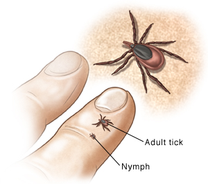 Nypmh and adult ticks shown on finger.