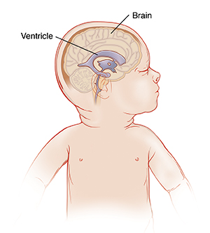 Side view of baby's head showing normal ventricles in brain.