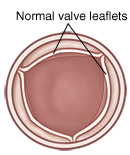 Top view of open pulmonary valve with normal leaflets.