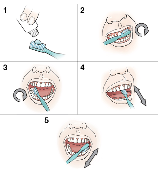 5 steps in proper toothbrushing
