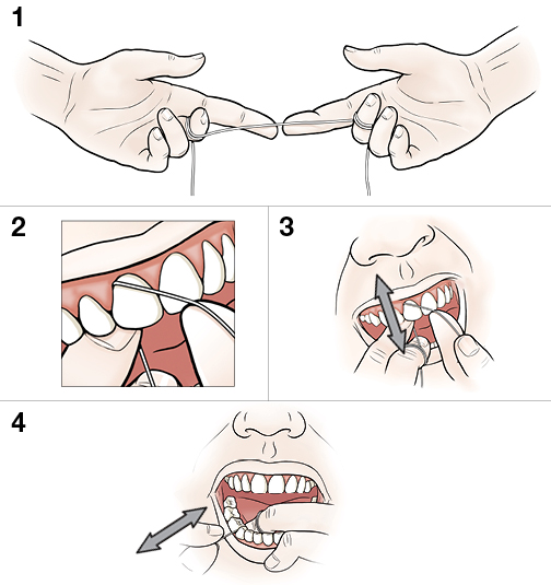 4 steps in flossing teeth