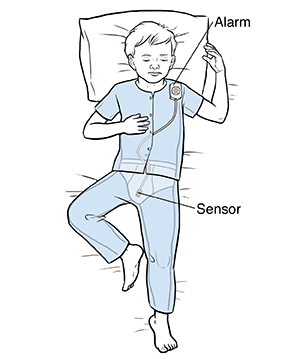Boy sleeping while wearing bedwetting sensor and alarm.