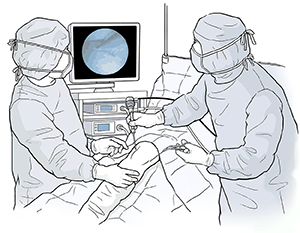 Two doctors performing knee arthroscopy on patient in operating room.
