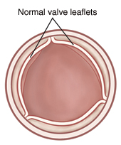 Top view of open aortic valve with normal leaflets.