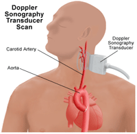 Doppler sonography transducer