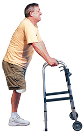 Man with amputated leg standing has walker out ahead of him, hands on grips.