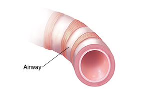 Cross section of bronchiole showing open airway.