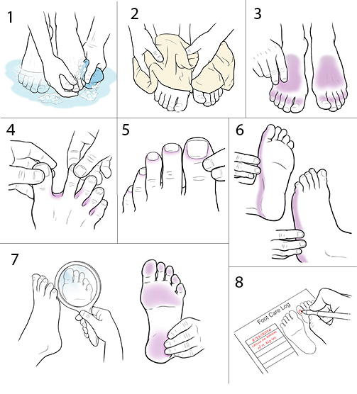 8 steps in showing how to inspect feet.
