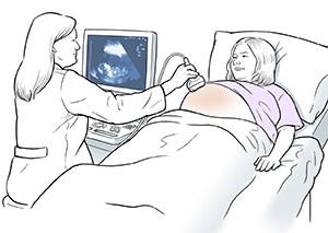Healthcare provider doing ultrasound exam on pregnant woman.