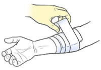 Gloved hand securing bandage on forearm with tape.
