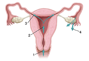 Front view cross section of female reproductive tract with arrows showing path through vagina, cervix, uterus, and out of fallopian tubes.