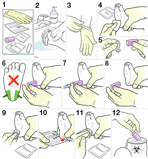 12 steps for doing a heel stick on a baby