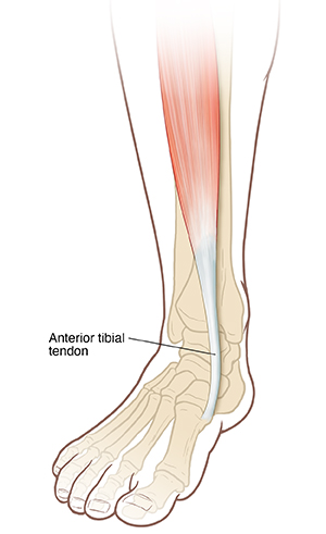 Front view of foot and lower leg showing foot bones and anterior tibial tendon.
