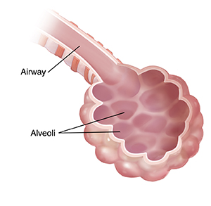 Closeup of normal airway and alveoli.