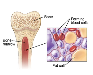 Cross-section of bone showing marrow and inset of blood components in marrow.