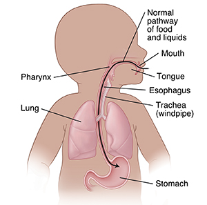 Outline of infant upper digestive system and normal pathway of food and liquids.