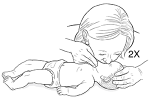 Woman with hands on chin and head of infant lying flat on back with head tilted back. Woman is covering the face and nose of infant with her mouth to give rescue breaths.
