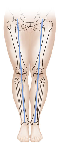 Front view of normal legs showing the bones. 