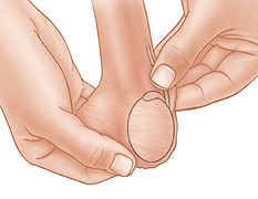 Closeup of hands checking vas during testicular self-exam.