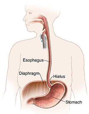 Outline of woman showing mouth, esophagus, diaphragm, and stomach.