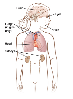 Outline of girl with head turned to side. Brain, lungs, heart, and kidneys are labeled inside body. Skin and eyes are labeled.