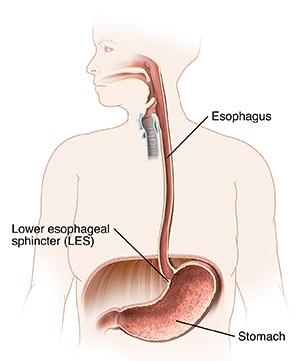 Front view of human figure showing esophagus and lower esophageal sphincter.