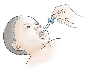 Una mano sobre el bebé sostiene una jeringa preparada para colocar un chorro de medicamento en la boca del bebé.