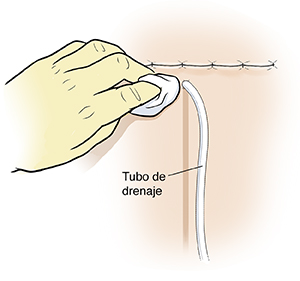 Primer plano de una mano con guante limpiando la piel alrededor de un tubo de drenaje cerca de la incisión quirúrgica.