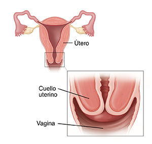 Corte transversal del útero con un recuadro que muestra un primer plano del cuello uterino.