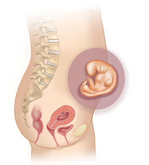 Vista lateral del cuerpo de una mujer donde se muestra el aparato reproductor. En el recuadro se muestra un embrión de 1 mes.