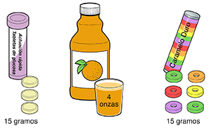 Ejemplos de 15 gramos de carbohidratos, donde se observan tabletas de glucosa, jugo de fruta y caramelos duros.