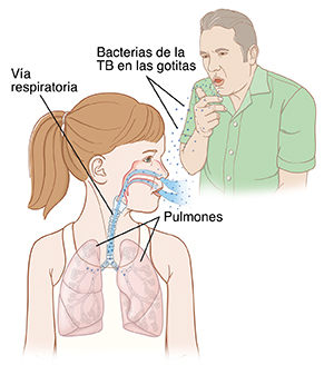 Un hombre tose y las gotitas con bacterias llegan a los pulmones de una niña cuando inhala.