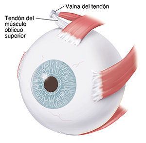 Vista de tres cuartos de un ojo donde pueden verse los músculos del ojo.