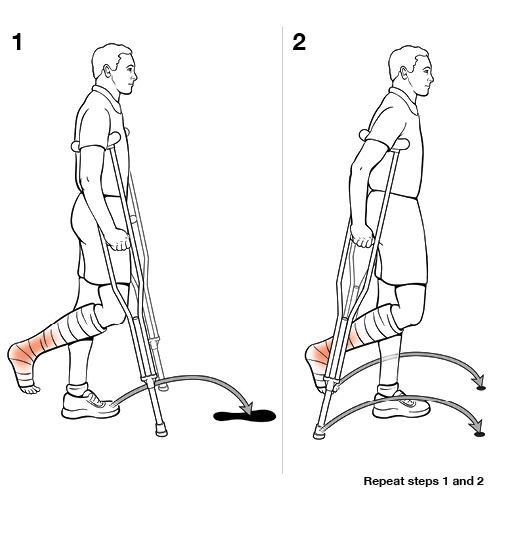 2 steps using crutches with swing through (non-weight bearing).