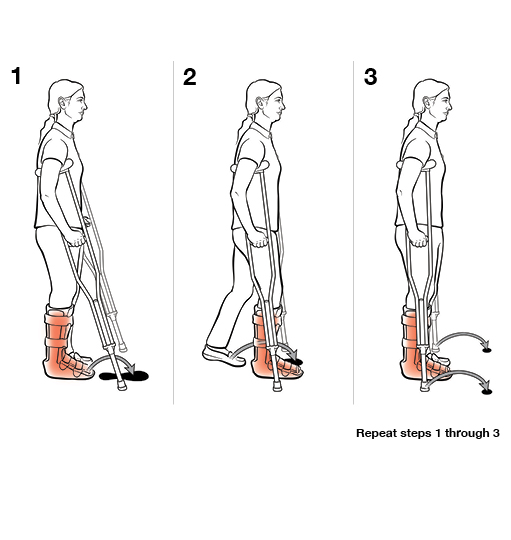 3 steps in using crutches with step to (weight bearing).