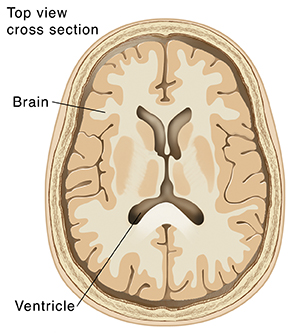 Top view cross section of brain showing ventricles.