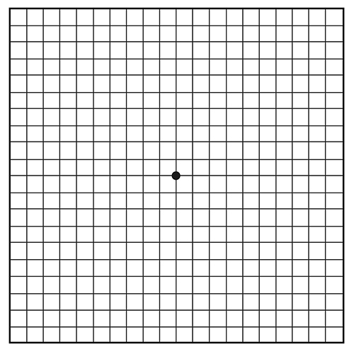 Amsler grid of black lines forming small squares and black dot in the center.