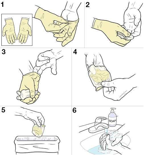 6 steps for removing sterile gloves.
