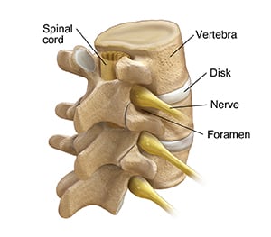 Three lumbar vertebrae, showing spinal cord in spinal column, and discs, nerves, and foramen.