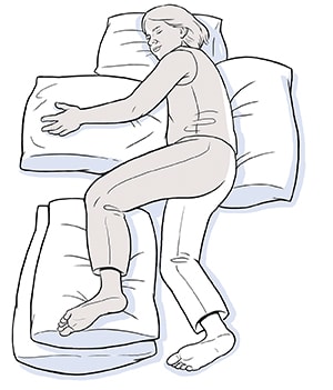 Person lying on side unaffected by stroke, pillows supporting head, back, and affected arm and leg.