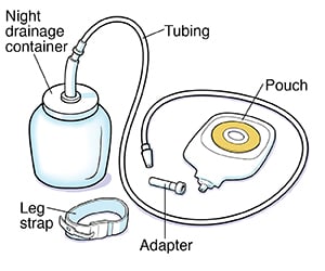 Parts of night drainage system. 